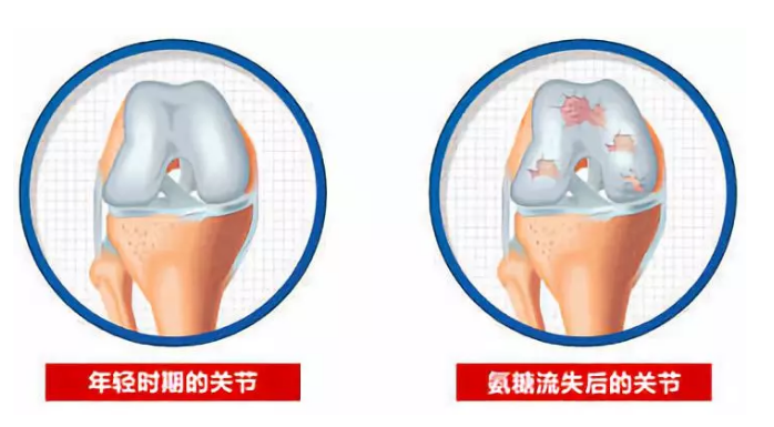 氨糖有什么作用？来给你详说！
