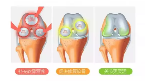 氨糖的作用是怎么发挥出来的？