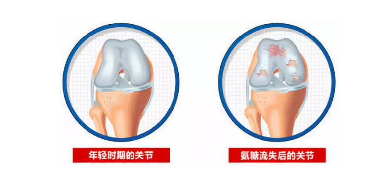 氨糖适用于什么样的人群？能起到哪些作用？