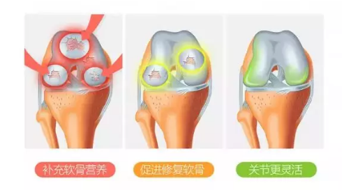 氨糖软骨素有什么作用？适合哪些人群使用？