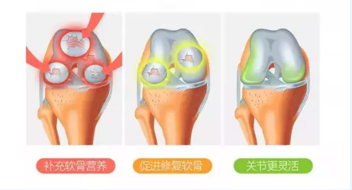 氨糖软骨素有什么作用？适合哪些人群？