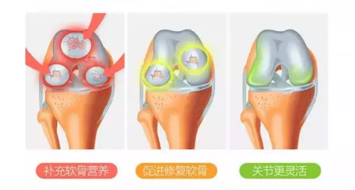 氨糖软骨素有什么成分？能起到什么作用？