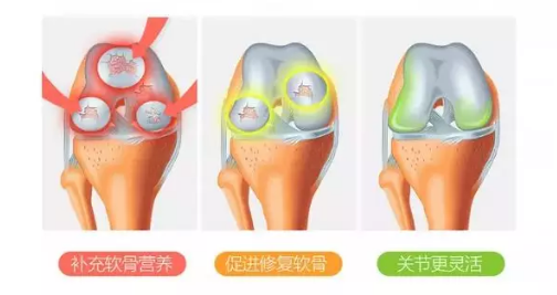 维力维氨糖软骨素怎么样？能起到什么作用？