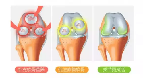 维力维详解：什么是维骨力？维骨力有哪些作用？