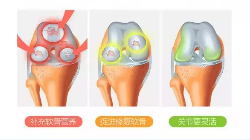 维力维氨糖软骨素中钙成分有什么作用？