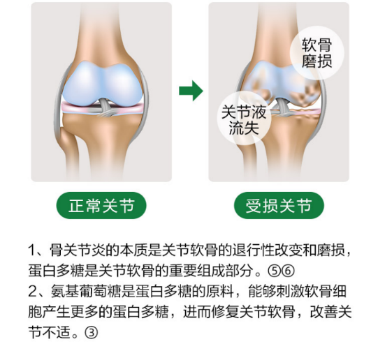 吃维力维氨糖软骨素补充氨糖有必要吗？