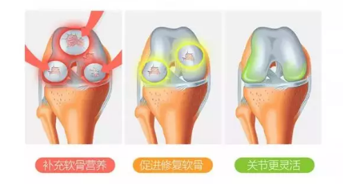 维力维详解:为何氨糖软骨素推荐选国产