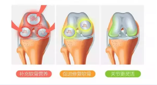 维力维氨基葡萄糖有哪些好处？