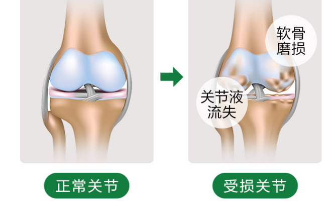 维力维氨基葡萄糖的价格是多少？