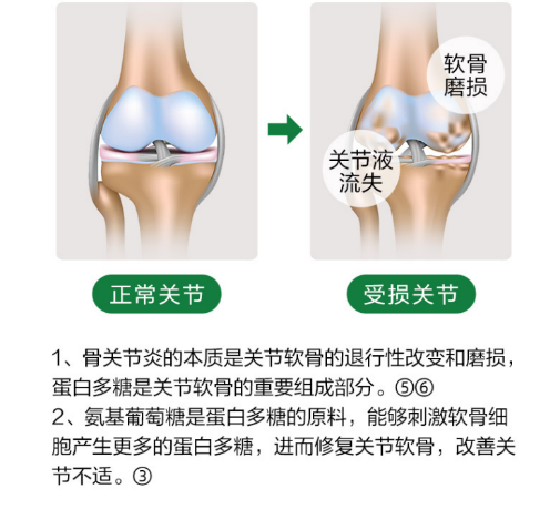 维力维氨基葡萄糖详解氨糖软骨素应该怎么选？
