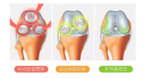 维力维氨糖软骨素中的骨胶原对于关节健康有哪些帮助？