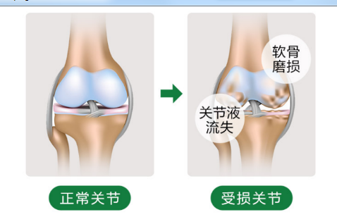 维力维氨基葡萄糖软骨素中加入了骨胶原对关节健康又哪些帮助？