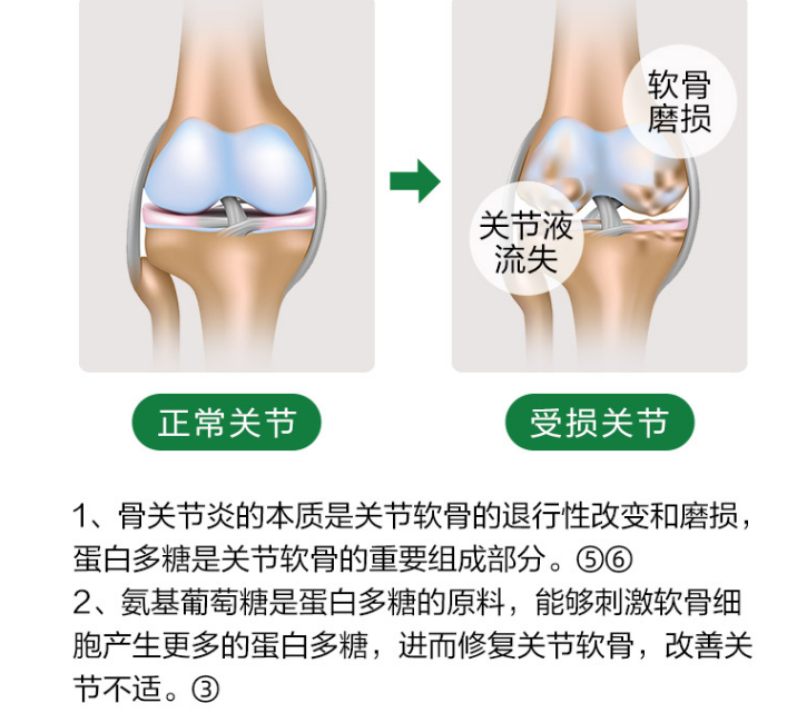 维力维氨糖软骨素可为关节提供更全面的保护