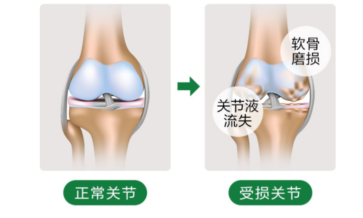 维力维氨糖软骨素中的氨糖能起到哪些作用？