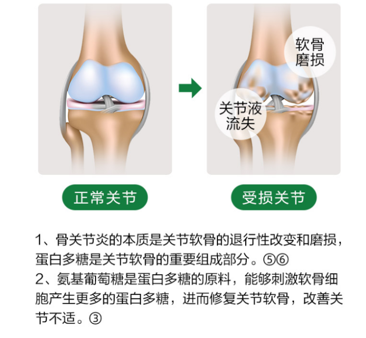 关节炎吃氨糖软骨素能够起到什么作用？