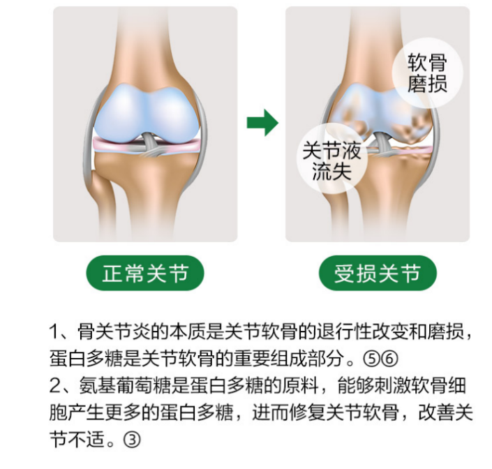 氨基葡萄糖对于关节炎能够起到哪些作用？