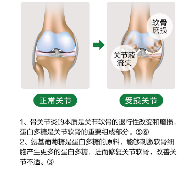 关节有问题为什么要吃氨糖软骨素呢？