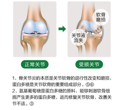 关节问题吃氨糖软骨素都有哪些作用？