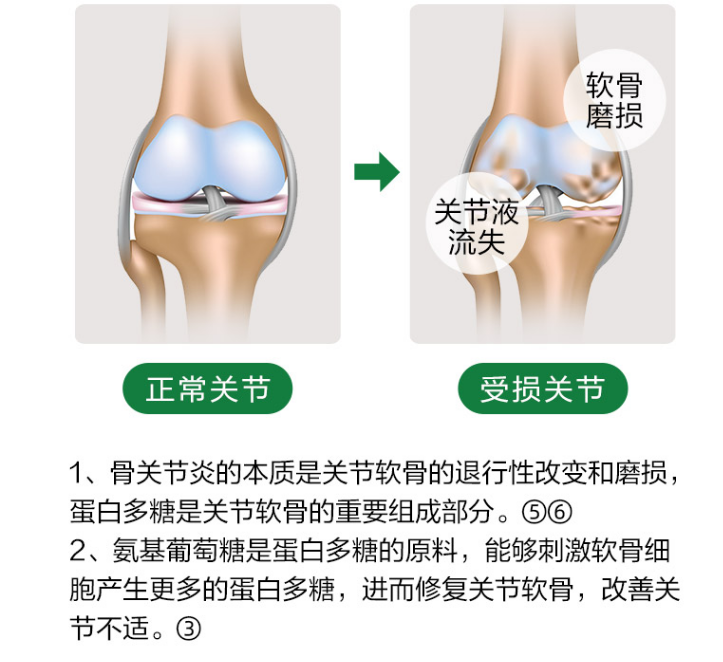 氨糖软骨素是什么？能够发挥什么作用？