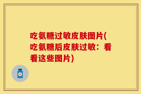 吃氨糖过敏皮肤图片(吃氨糖后皮肤过敏：看看这些图片)