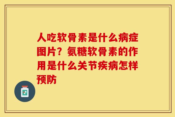人吃软骨素是什么病症图片？氨糖软骨素的作用是什么关节疾病怎样预防
