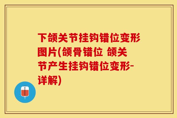 下颌关节挂钩错位变形图片(颌骨错位 颌关节产生挂钩错位变形-详解)