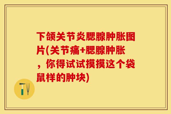 下颌关节炎腮腺肿胀图片(关节痛+腮腺肿胀，你得试试摸摸这个袋鼠样的肿块)