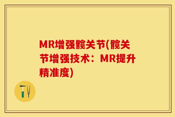 MR增强髋关节(髋关节增强技术：MR提升精准度)