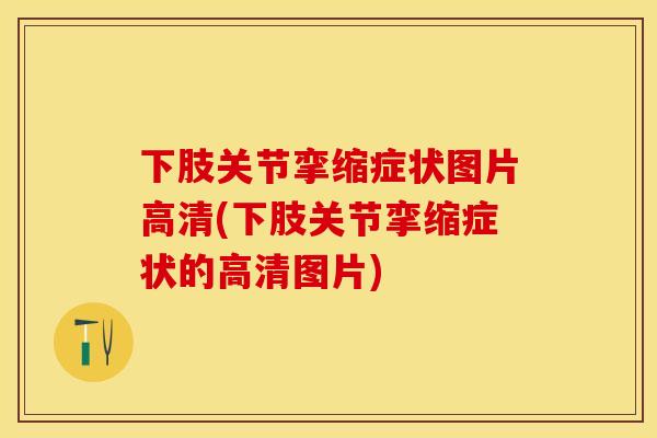 下肢关节挛缩症状图片高清(下肢关节挛缩症状的高清图片) 下肢关节挛缩症状图片高清(下肢关节挛缩症状的高清图片)