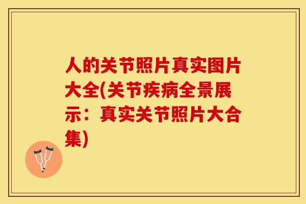 人的关节照片真实图片大全(关节疾病全景展示：真实关节照片大合集)