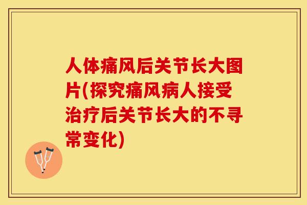 人体痛风后关节长大图片(探究痛风病人接受治疗后关节长大的不寻常变化)