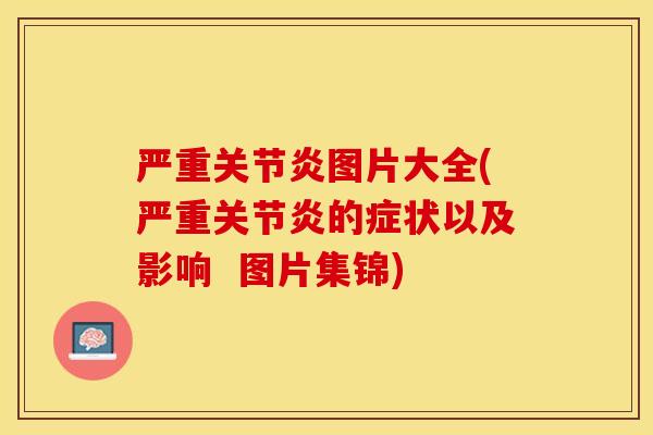 严重关节炎图片大全(严重关节炎的症状以及影响  图片集锦)