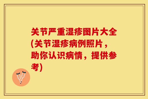 关节严重图片大全(关节例照片,助你认识情,提供参考) 关节严重图片大全(关节例照片,助你认识情,提供参考)