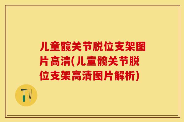 儿童髋关节脱位支架图片高清(儿童髋关节脱位支架高清图片解析)