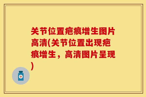 关节位置疤痕增生图片高清(关节位置出现疤痕增生，高清图片呈现)