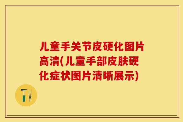 儿童手关节皮硬化图片高清(儿童手部皮肤硬化症状图片清晰展示)