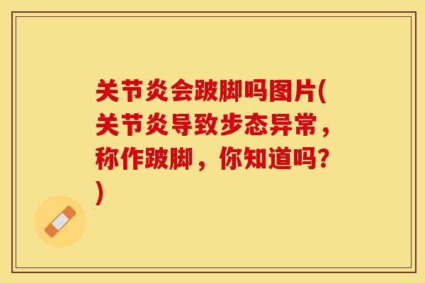 关节炎会跛脚吗图片(关节炎导致步态异常，称作跛脚，你知道吗？)