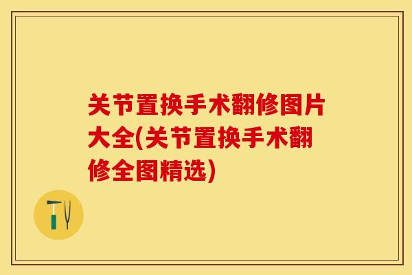 关节置换手术翻修图片大全(关节置换手术翻修全图精选)