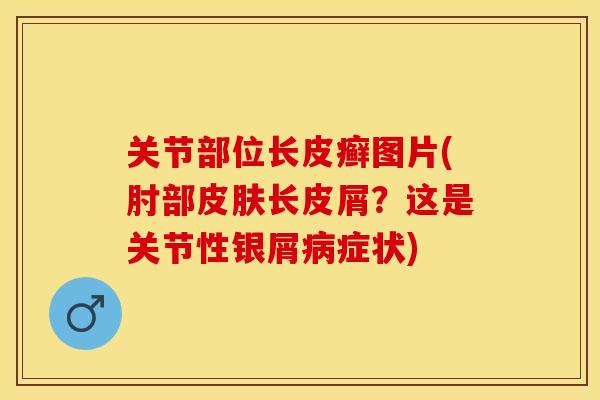 关节部位长皮癣图片(肘部皮肤长皮屑？这是关节性银屑病症状)