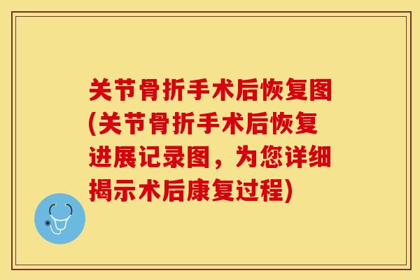 关节手术后恢复图(关节手术后恢复进展记录图，为您详细揭示术后康复过程)