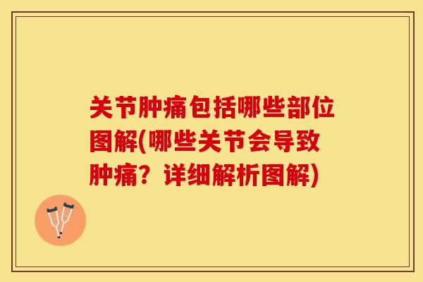 关节肿痛包括哪些部位图解(哪些关节会导致肿痛?详细解析图解) 关节肿痛包括哪些部位图解(哪些关节会导致肿痛?详细解析图解)