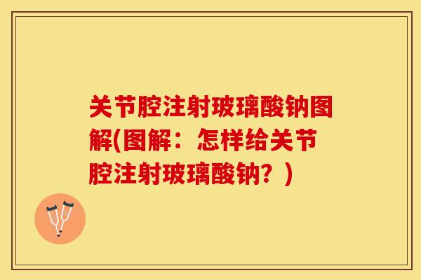 关节腔注射玻璃酸钠图解(图解：怎样给关节腔注射玻璃酸钠？)