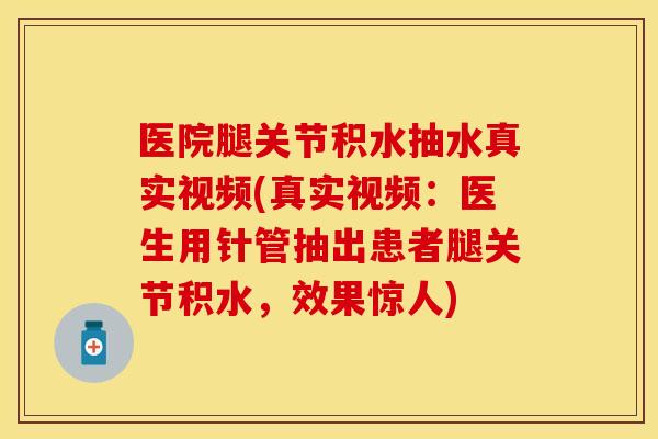 医院腿关节积水抽水真实视频(真实视频：医生用针管抽出患者腿关节积水，效果惊人)