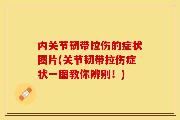 内关节韧带拉伤的症状图片(关节韧带拉伤症状一图教你辨别！)