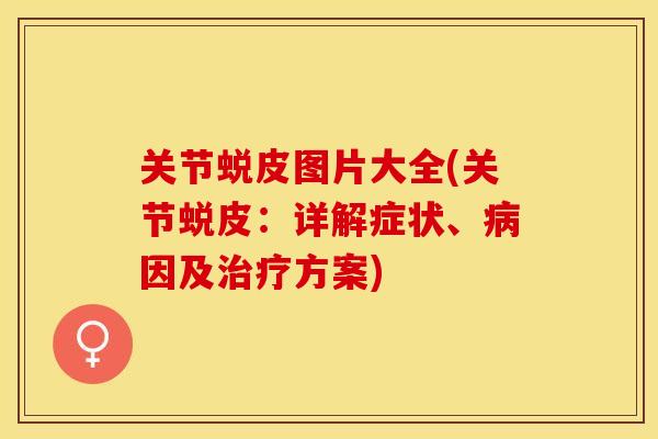 关节蜕皮图片大全(关节蜕皮：详解症状、病因及治疗方案)