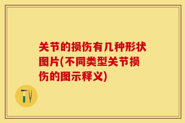 关节的损伤有几种形状图片(不同类型关节损伤的图示释义)