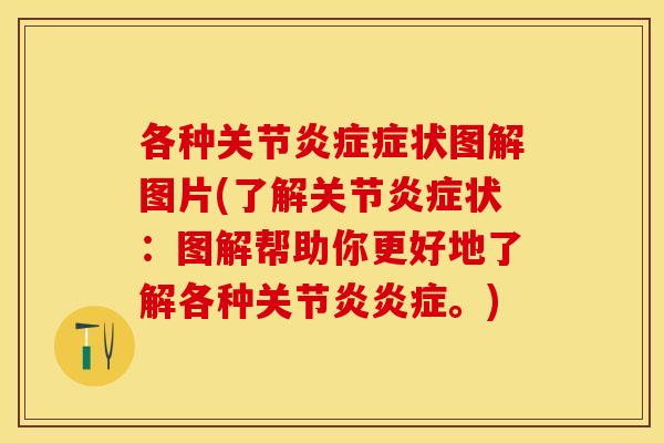 各种关节症状图解图片(了解关节状：图解帮助你更好地了解各种。)
