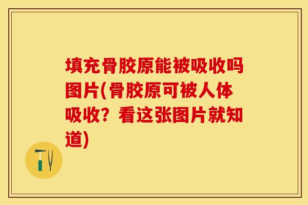 填充骨胶原能被吸收吗图片(骨胶原可被人体吸收?看这张图片就知道) 填充骨胶原能被吸收吗图片(骨胶原可被人体吸收?看这张图片就知道)