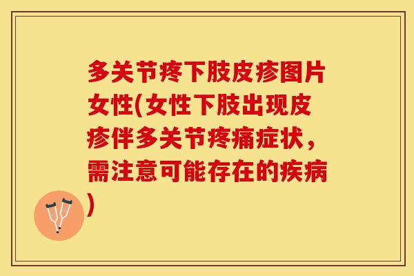 多关节疼下肢皮疹图片女性(女性下肢出现皮疹伴多关节疼痛症状，需注意可能存在的疾病)