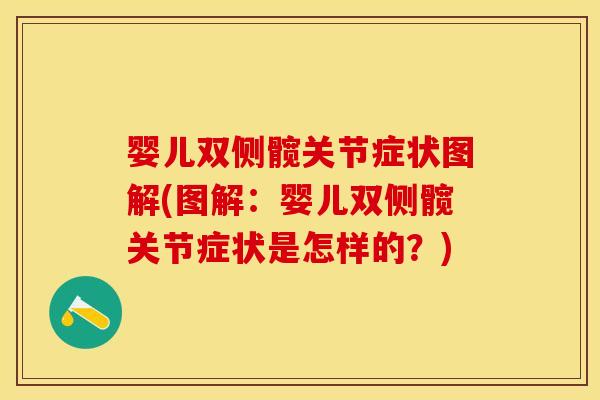 婴儿双侧髋关节症状图解(图解:婴儿双侧髋关节症状是怎样的?) 婴儿双侧髋关节症状图解(图解:婴儿双侧髋关节症状是怎样的?)